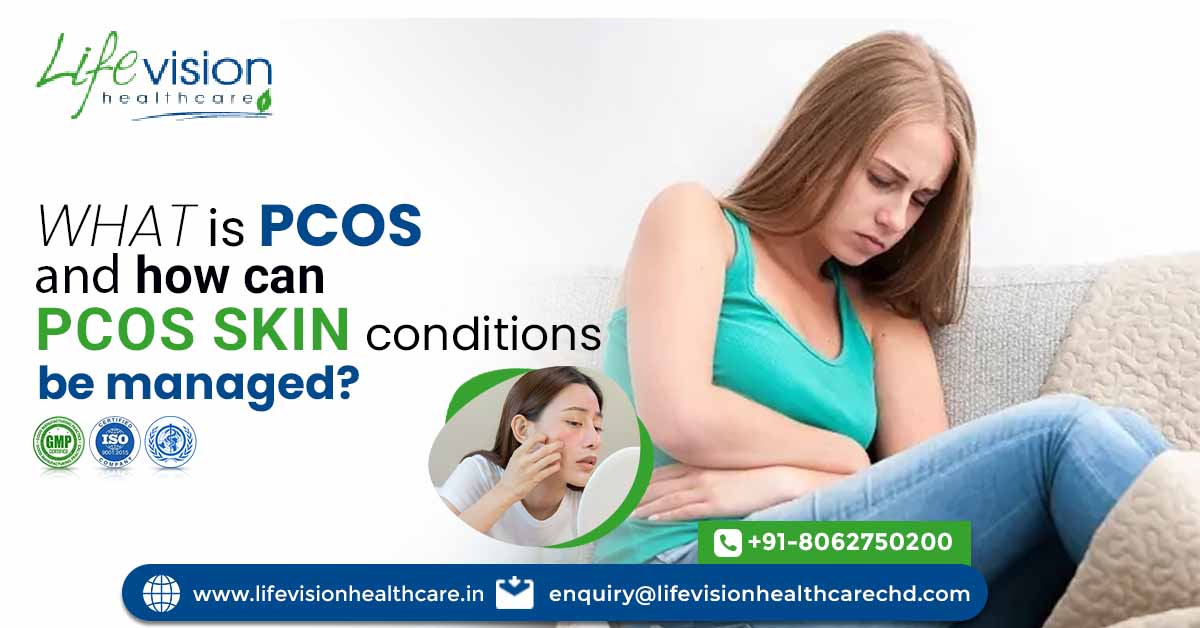What Is PCOS And How Can PCOS Skin Conditions Be Managed? | Lifevision Healthcare